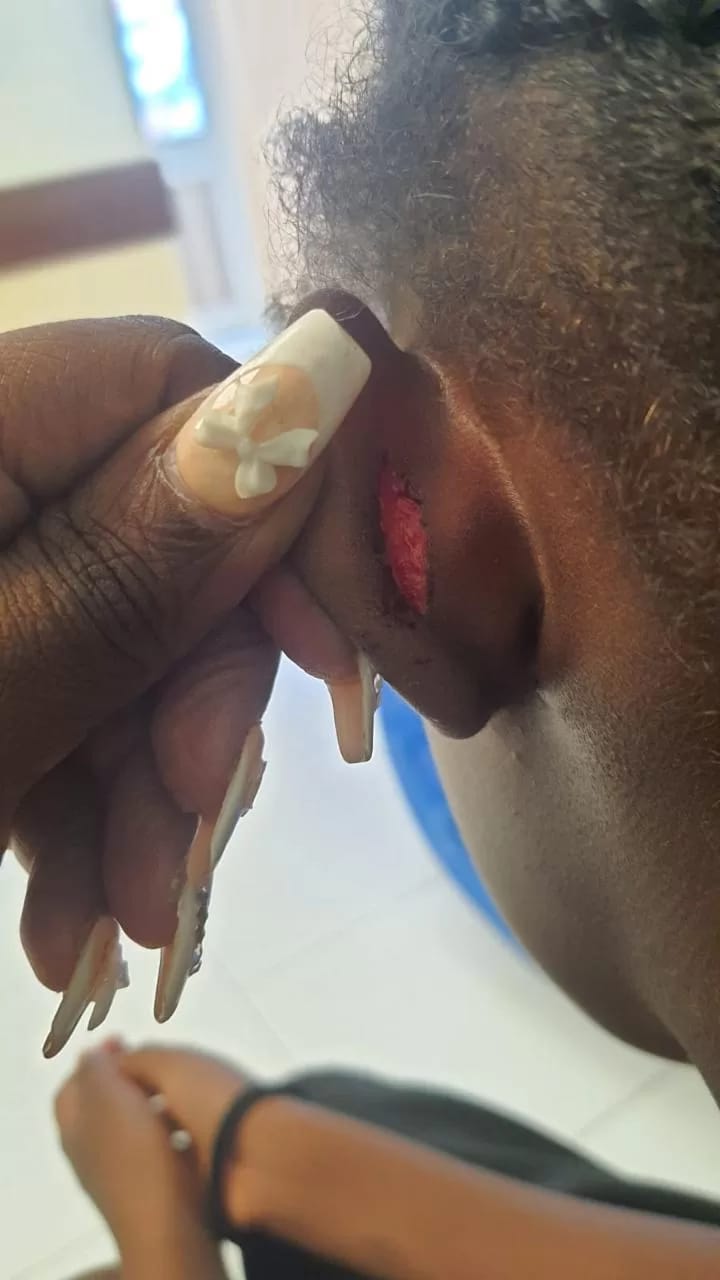 Graphic photo showing the injuries inflicted on the victim.