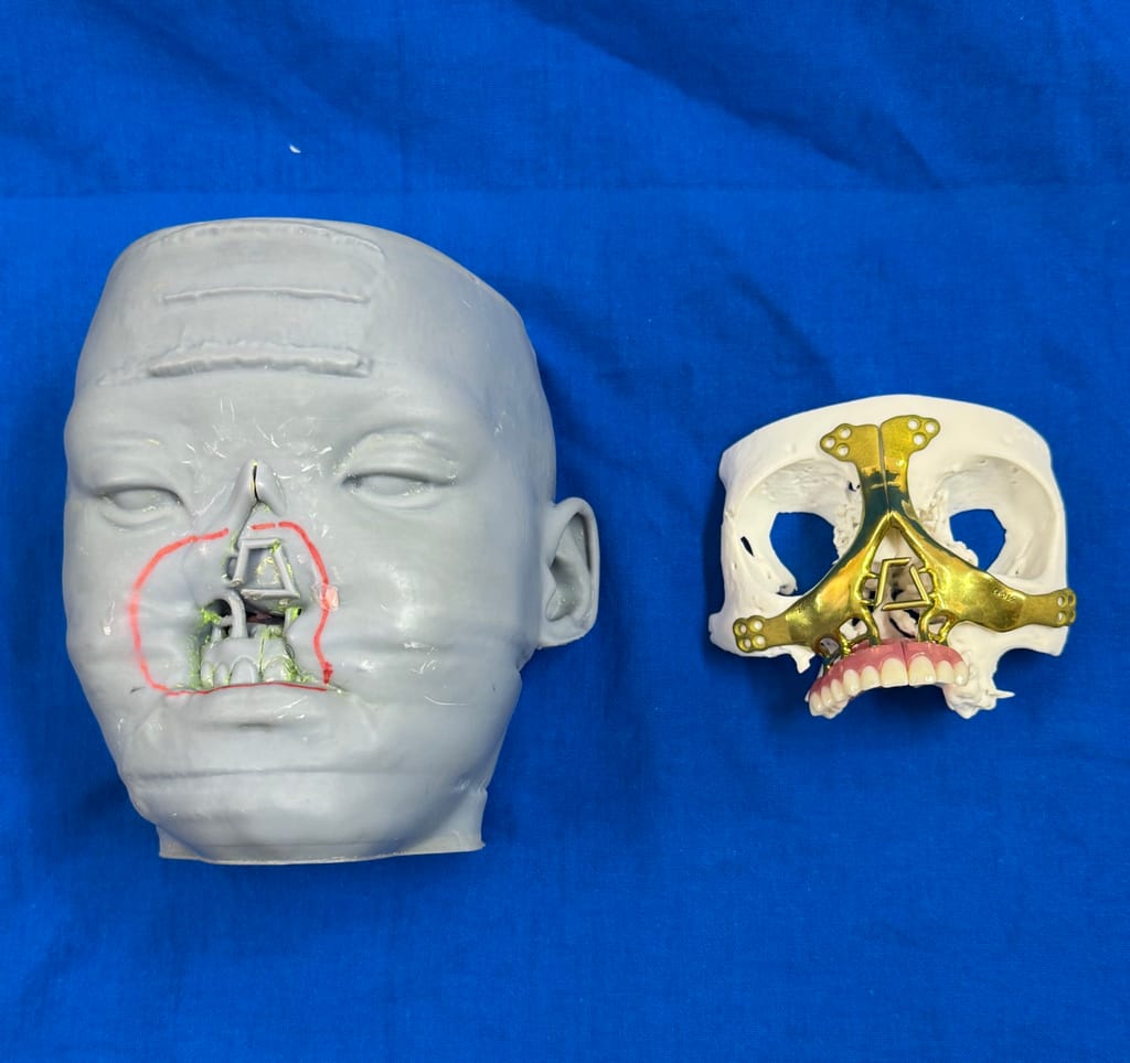 Illustration of the face and the face reconstruction.