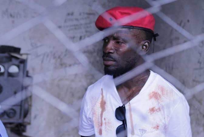 Uganda: His Bones Have Been Broken But His Spirit Hasn’t Been Crushed, Bobi Wine’s Wife Speaks Out After Seeing Him The First Time
