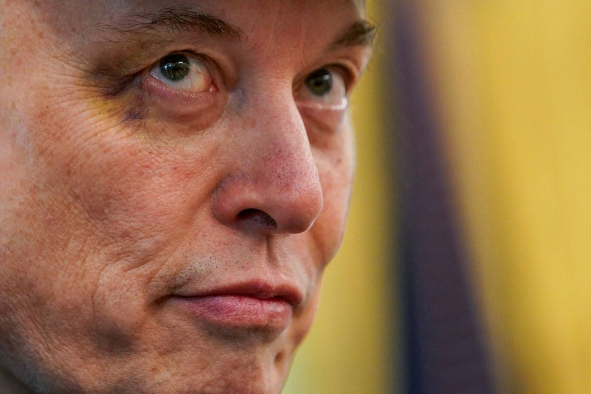 Elon Musk Attends Trump Event With Black Eye