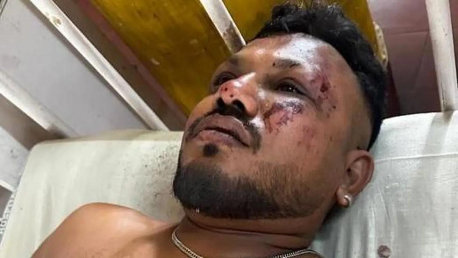 One Survivor Confirmed in The Air India Fatal Plane Crash With 242 People on Board‬