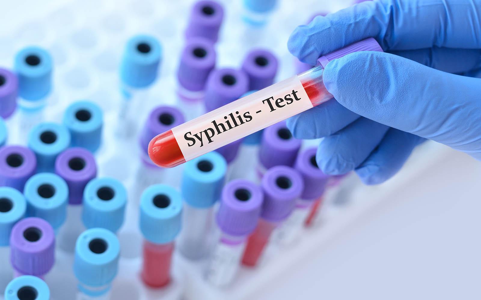 Alarm Over Spike in Syphilis Infections With Women Mostly Hit